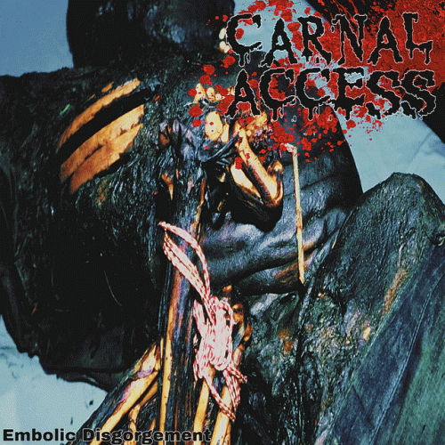 Embolic Disgorgement